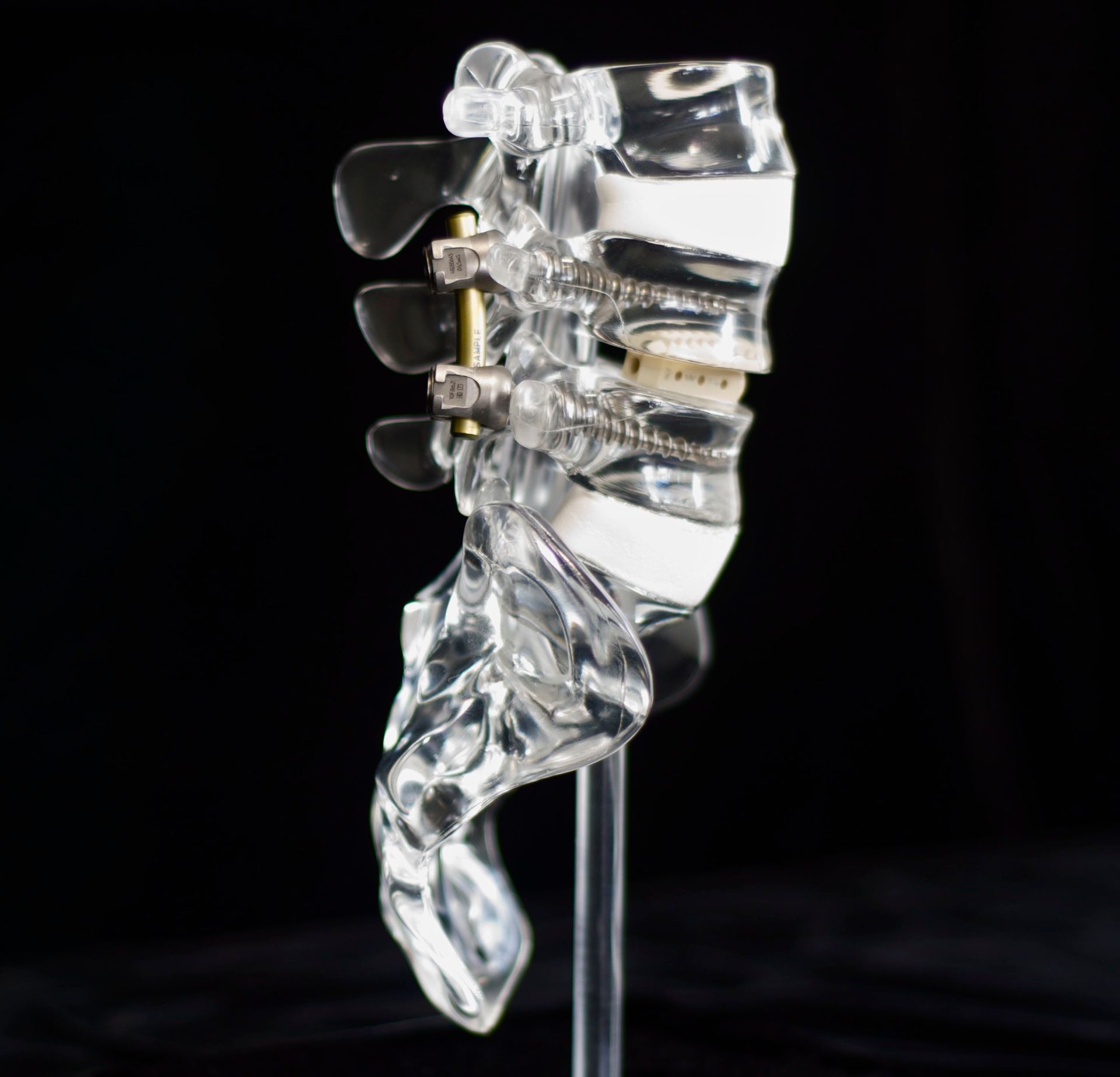 A clear model of a spine on a stand