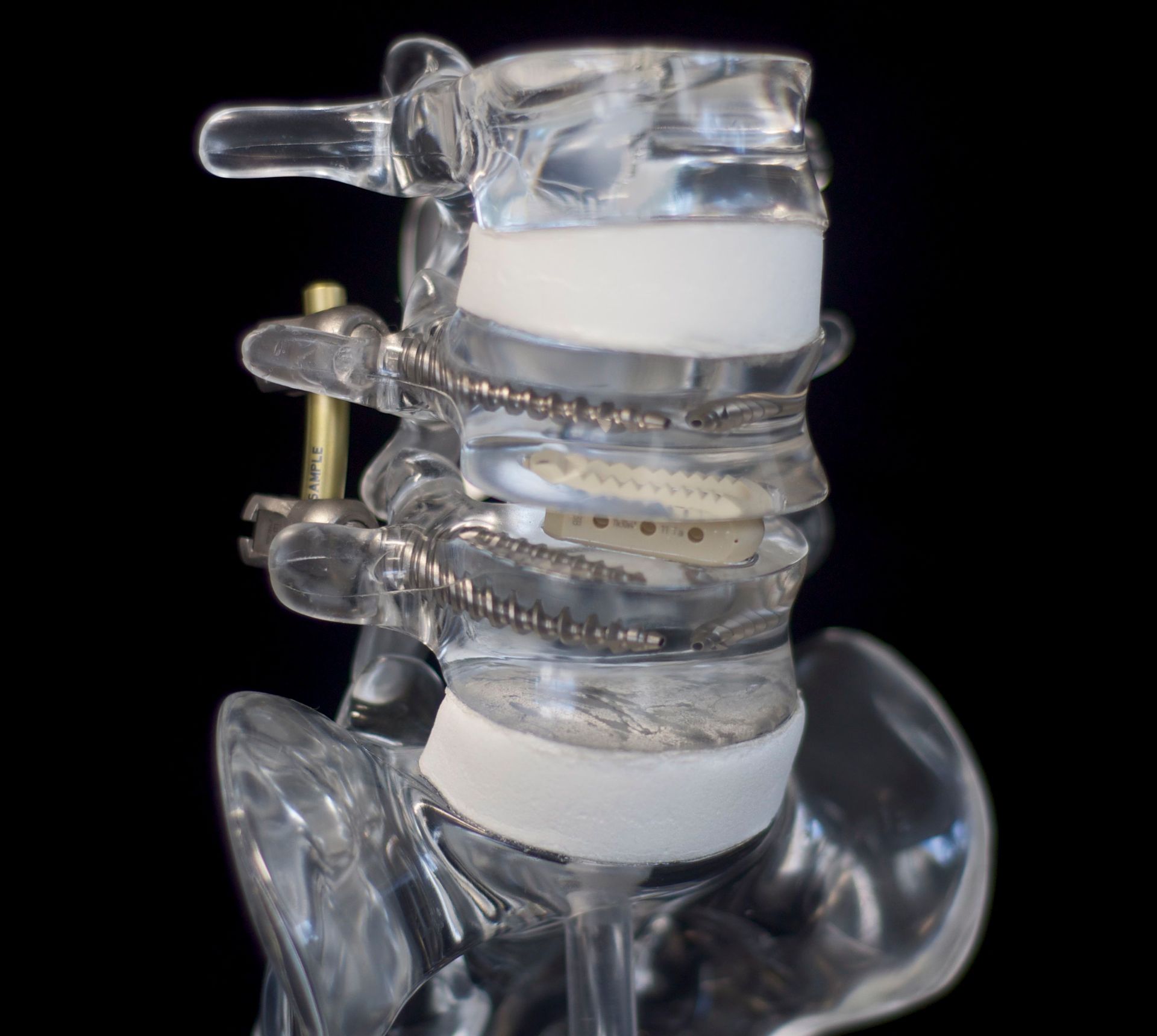 A clear model of a spine with a black background