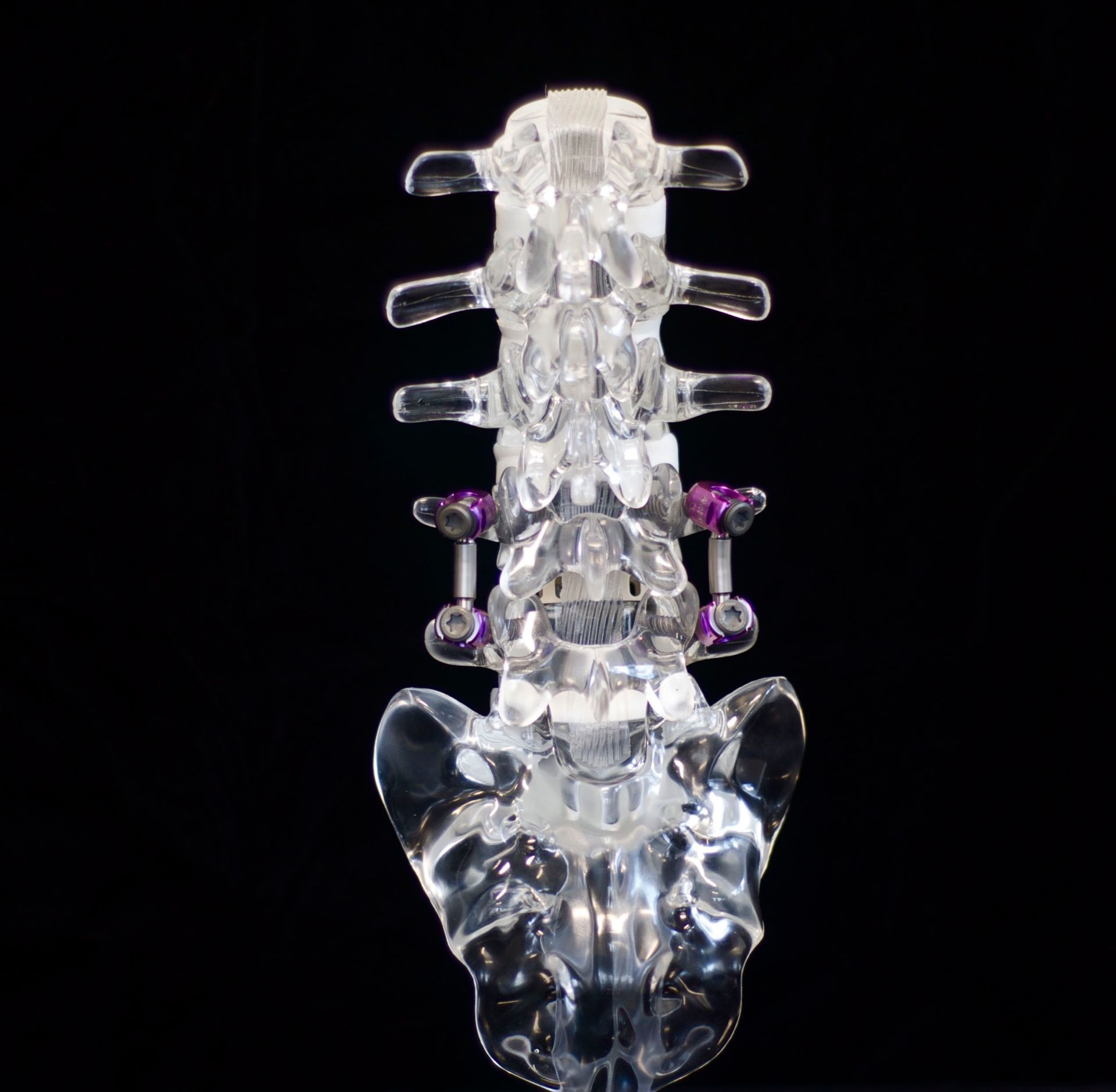 A clear model of a human spine with purple screws on a black background.