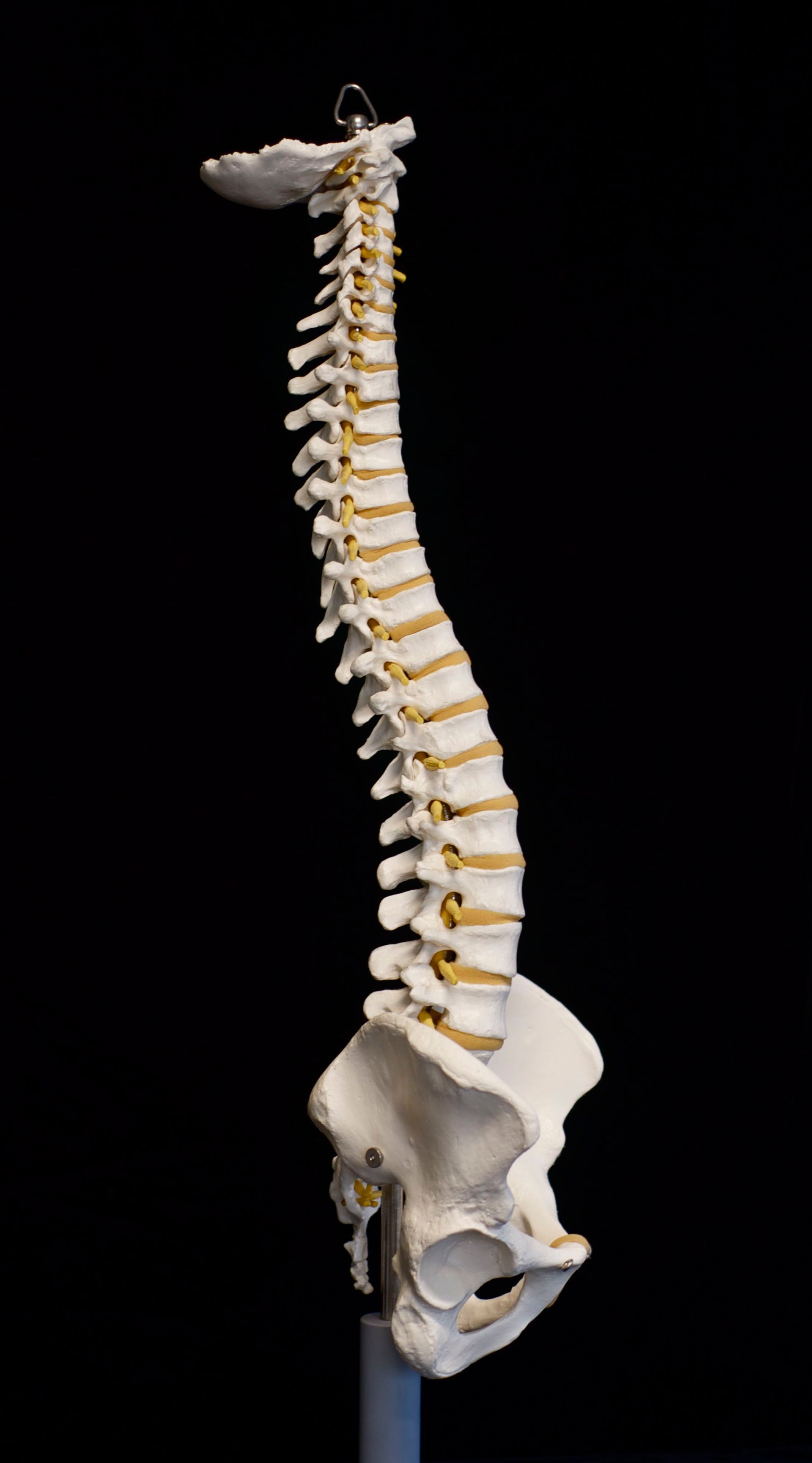 A model of a human spine and pelvis on a black background.