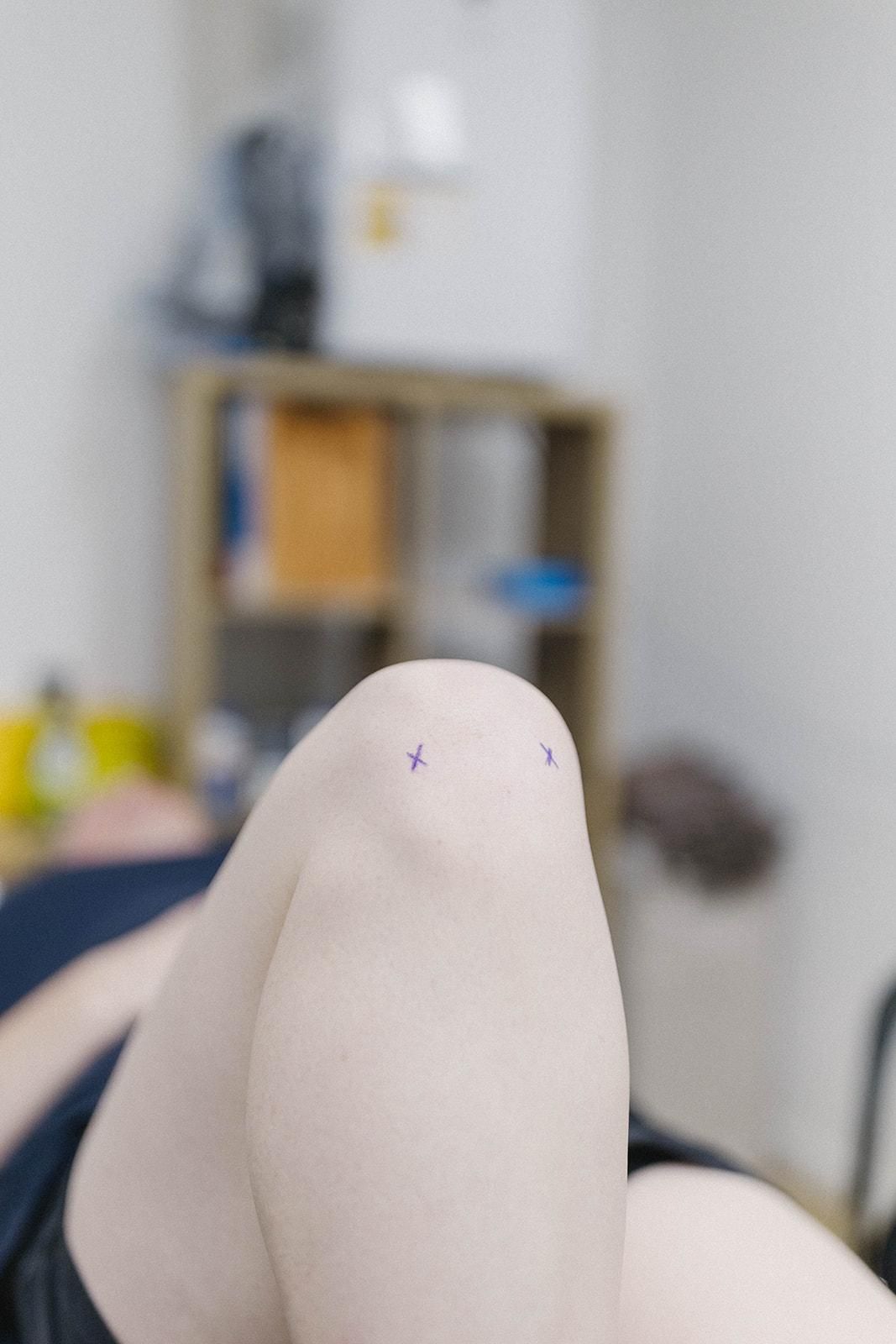 A Close Up of a Person's Knee With a Tattoo on It — Biomedical Sports Podiatry in Forster, NSW