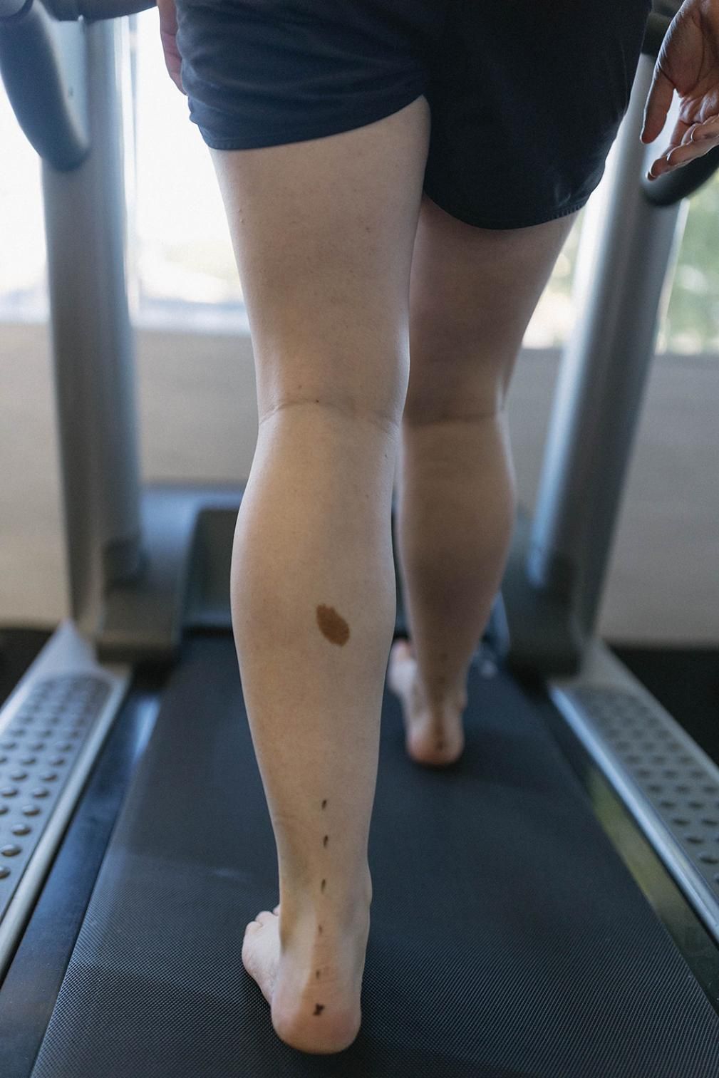A Person is Walking Barefoot on a Treadmill — Biomedical Sports Podiatry in Taree, NSW