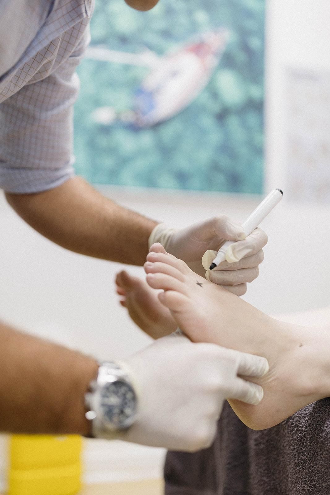 A Doctor is Examining a Patient's Foot With a Marker — Biomedical Sports Podiatry in Forster, NSW