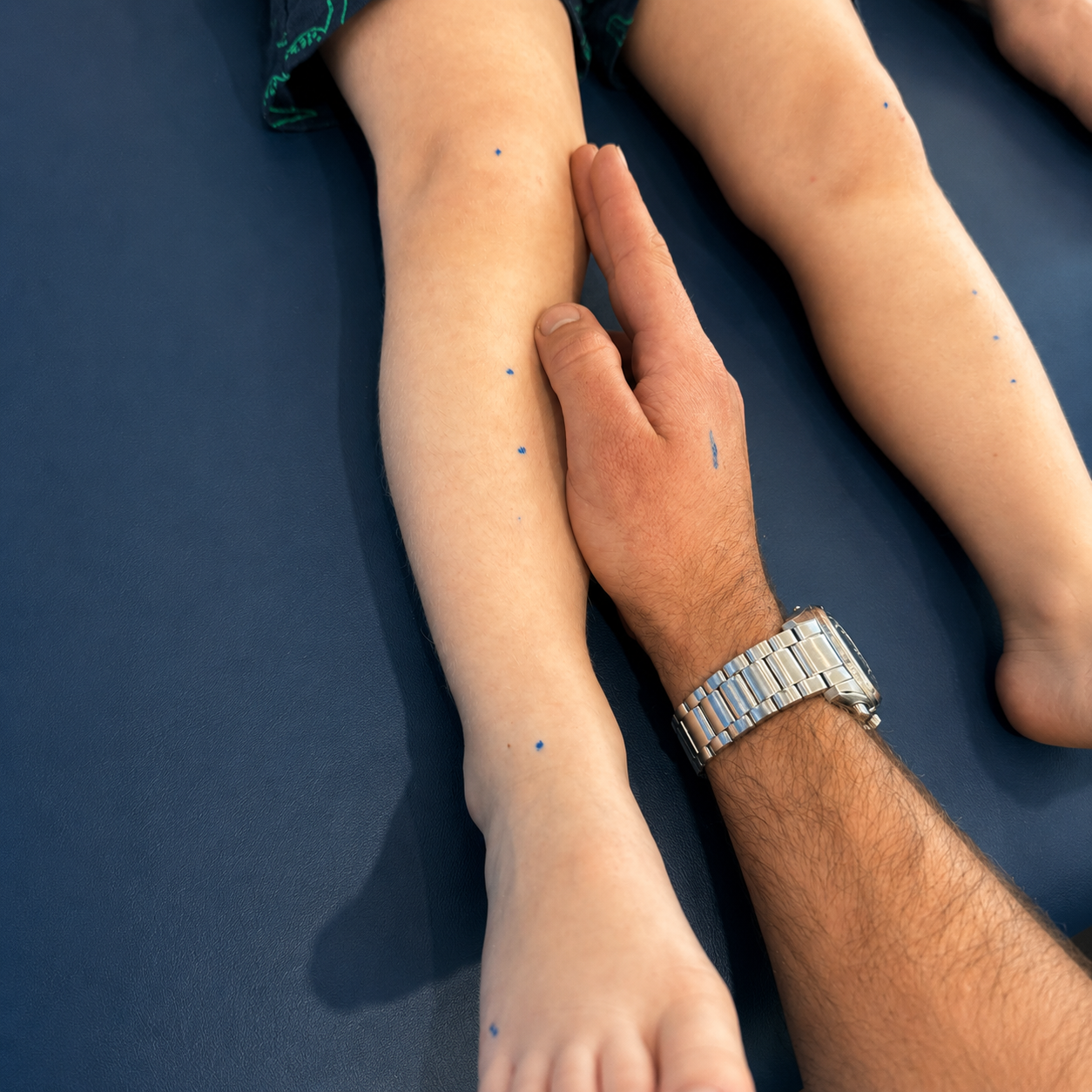 Hand holding a person’s lower leg beside another leg on a blue surface — Biomedical Sports Podiatry in Forster, NSW
