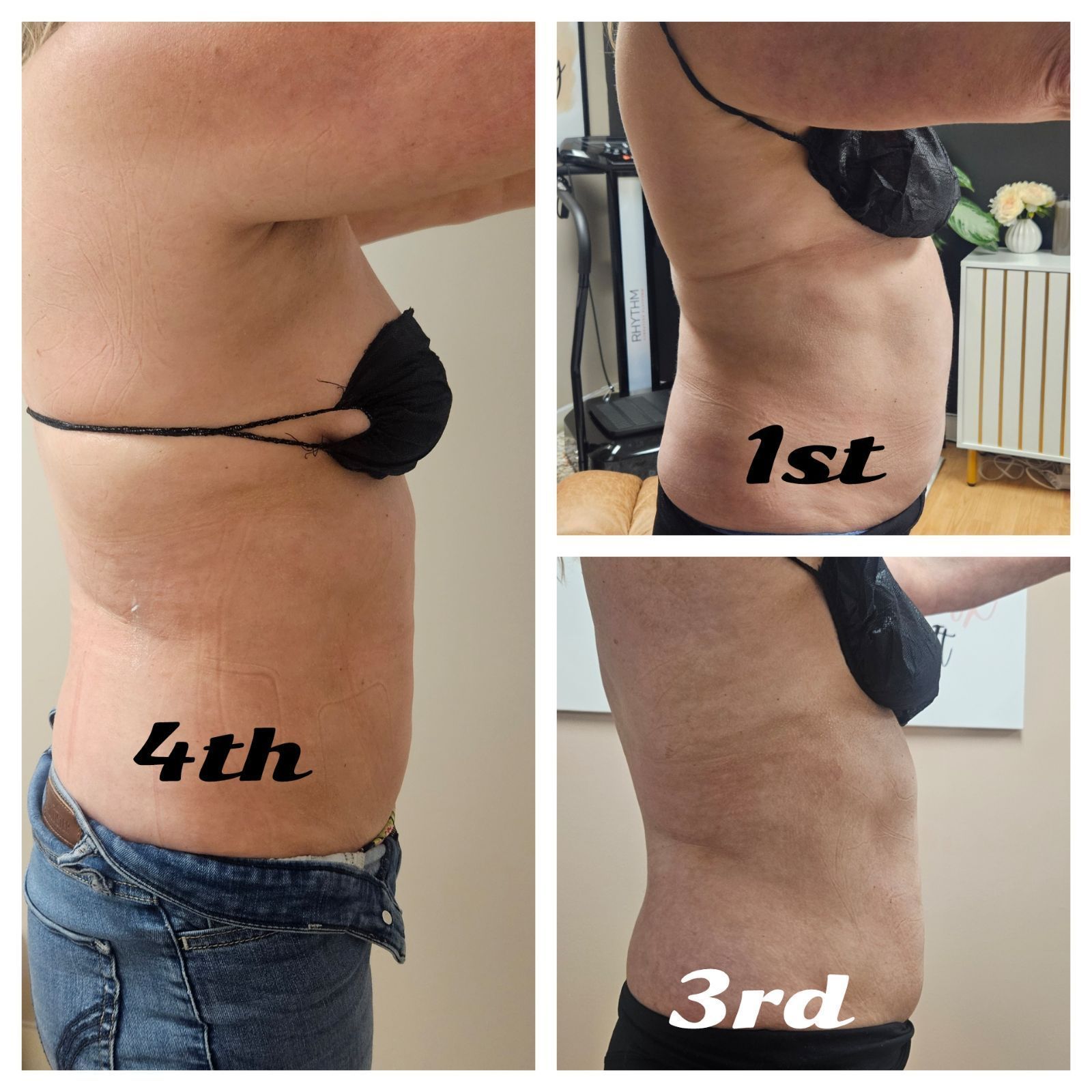 Three pictures of a woman 's stomach with the words 4th 1st and 3rd