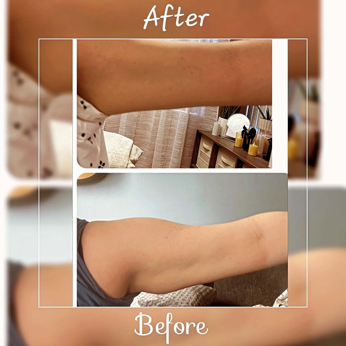A before and after photo of a woman 's arm