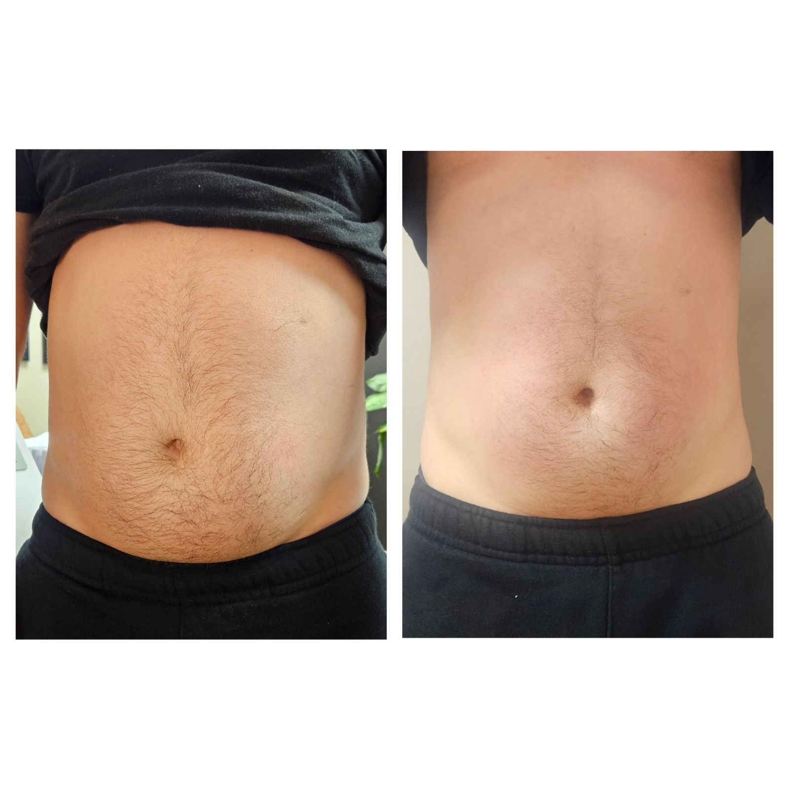 A before and after picture of a man 's stomach.