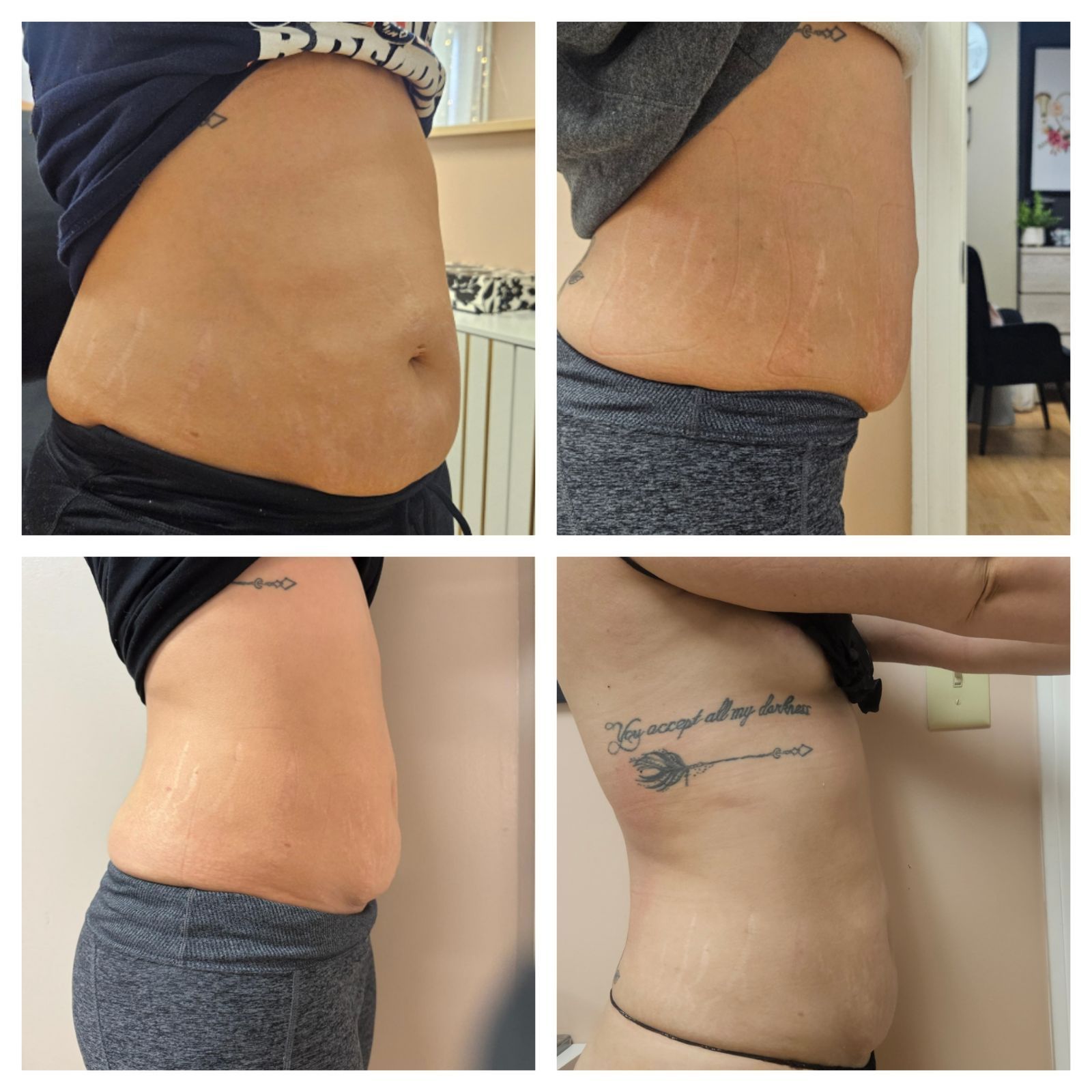 A woman 's stomach is shown in a collage of four photos