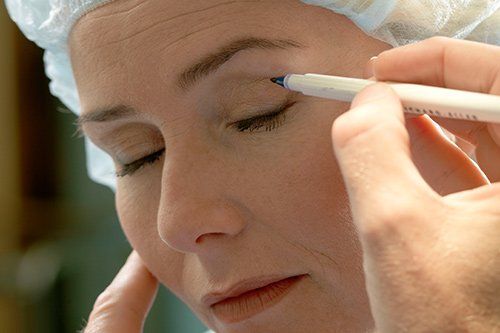 a patient preparing for cosmetic surgery a patient preparing for cosmetic surgery