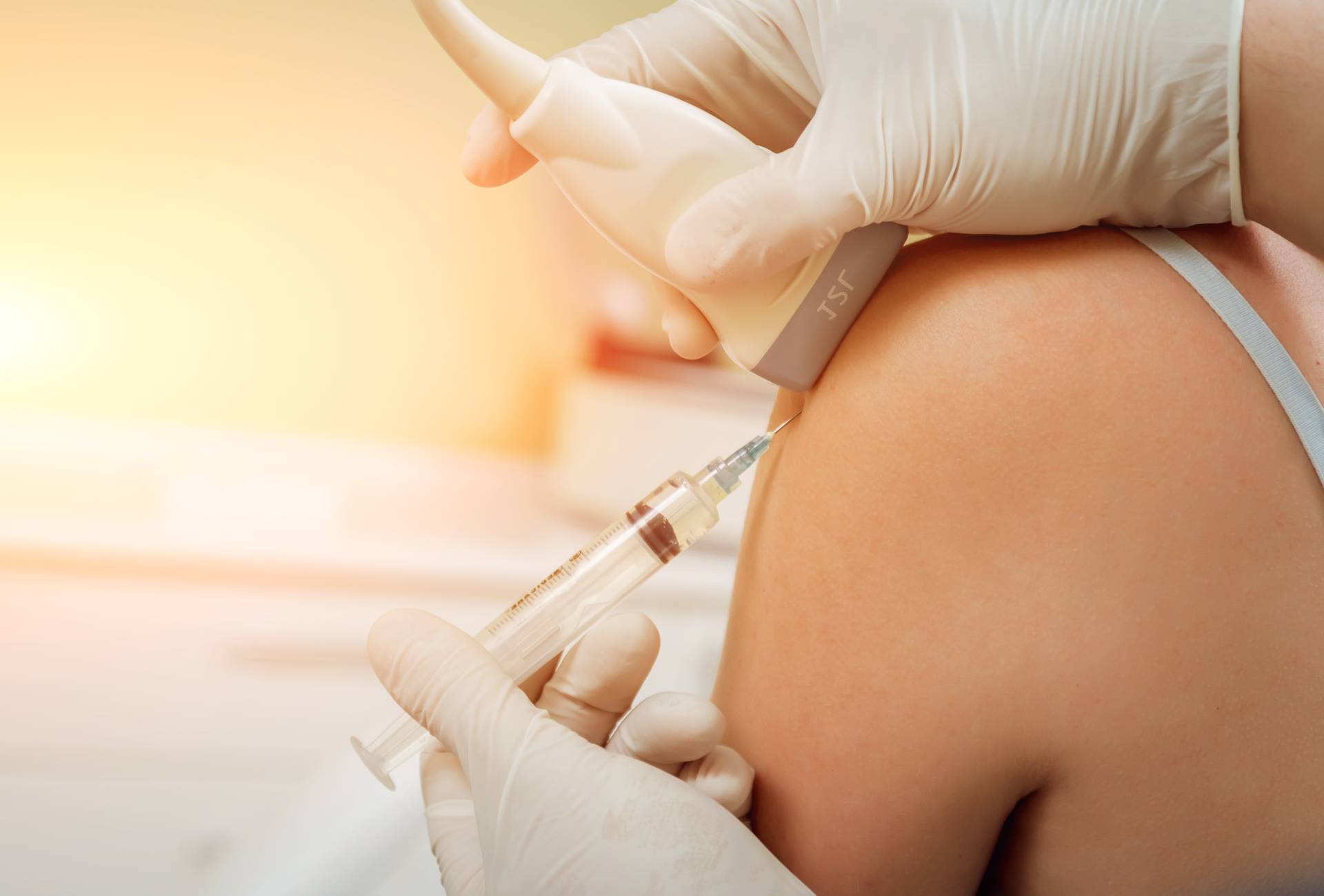 Una donna riceve un'iniezione nel braccio.