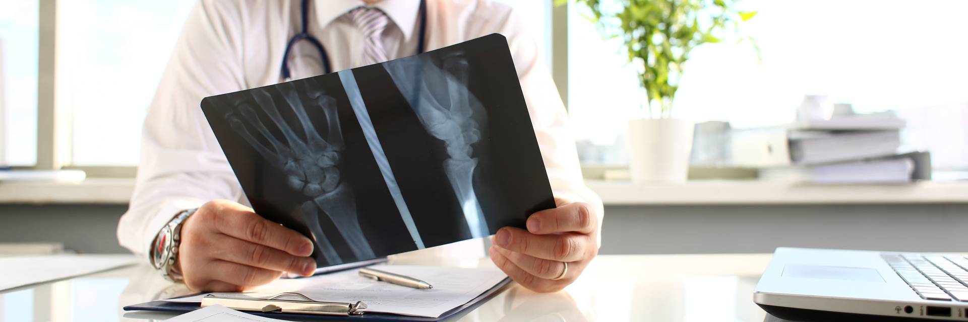 Un medico tiene in mano una radiografia di una mano.