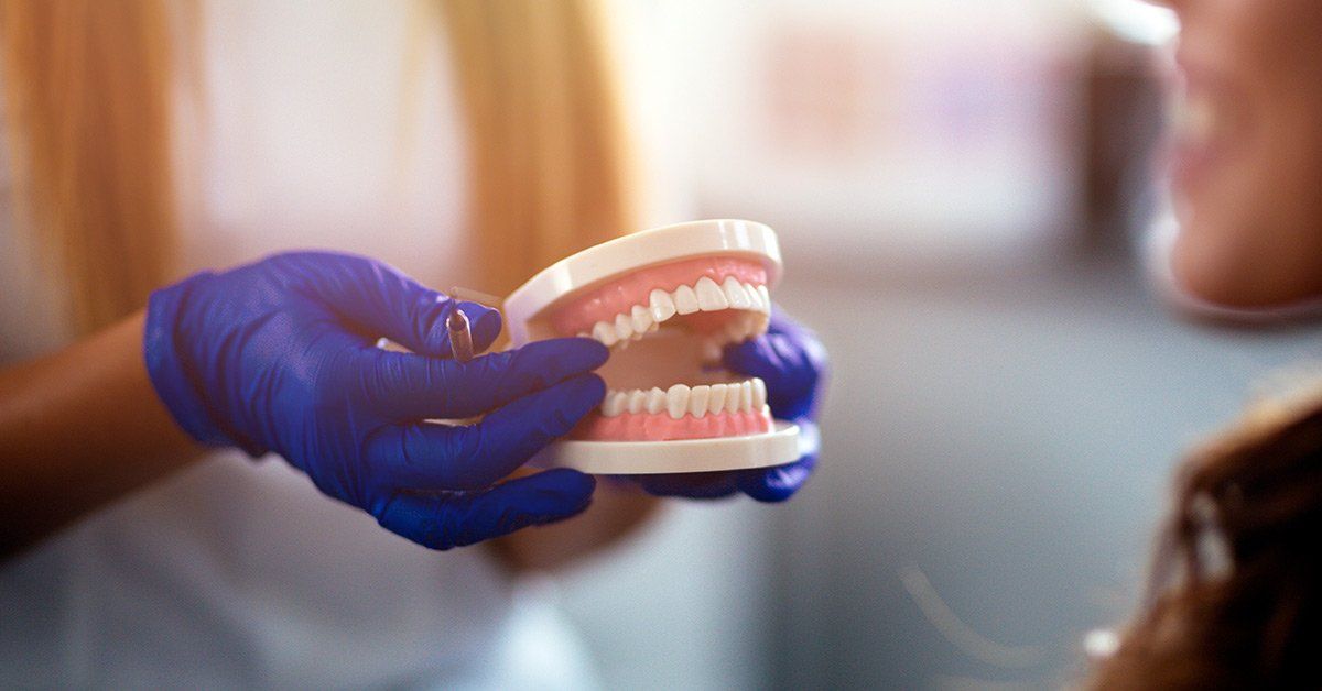 complete dentures
