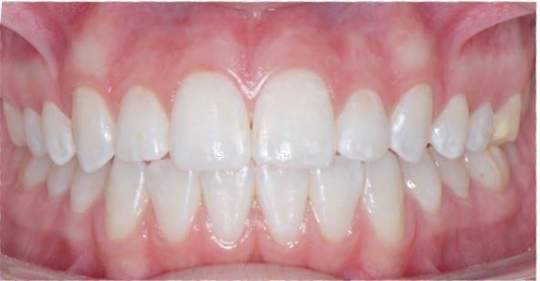 Sample Images for City Centre Orthodontics Virtual Consultation