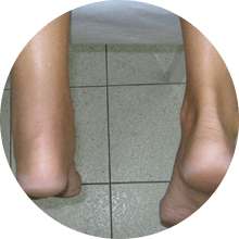 achilles tendon in pain