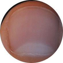 a toenail