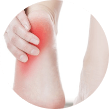pain in heel plantar fasciitis