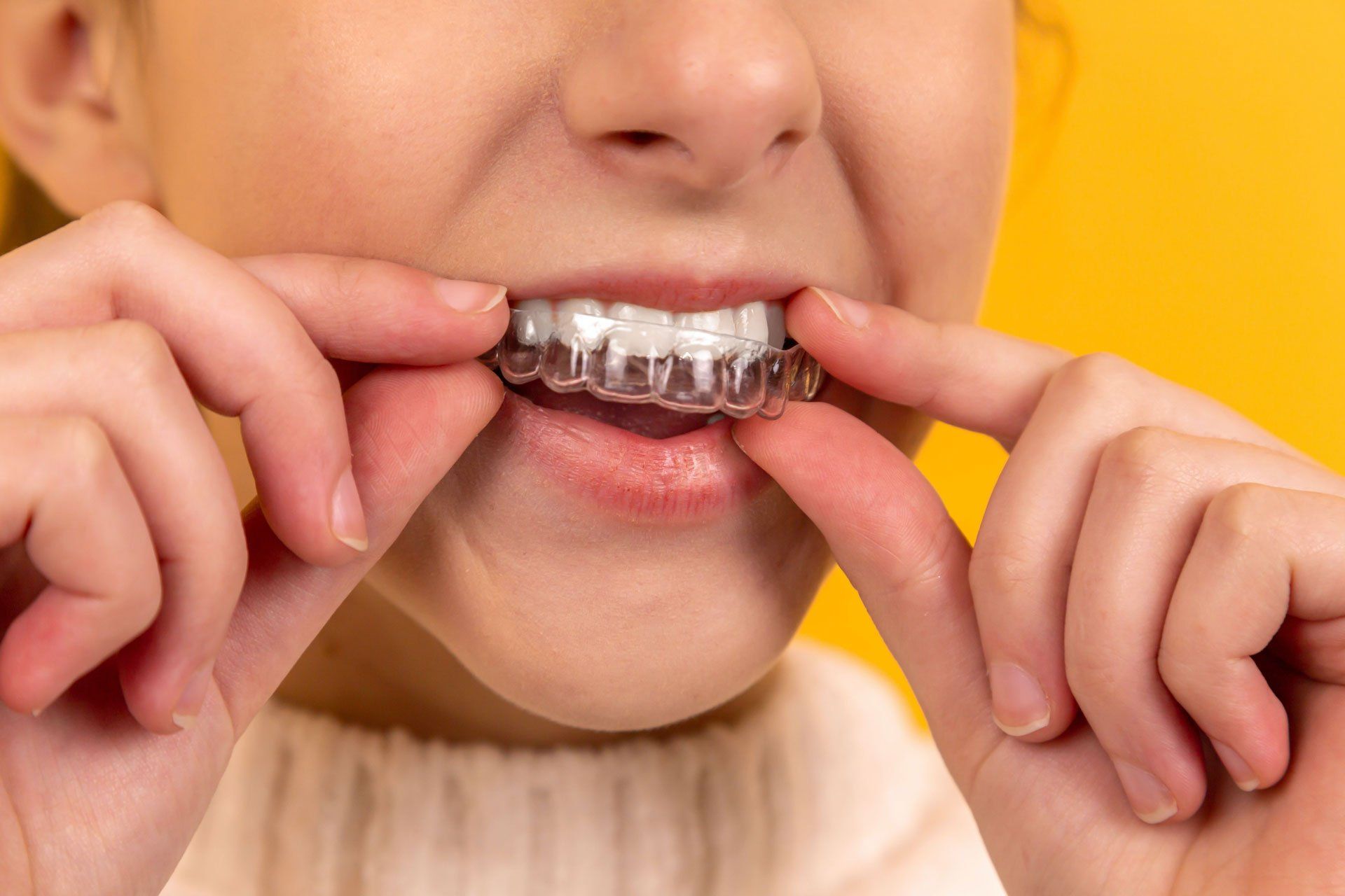 A woman is putting a clear brace on her teeth.