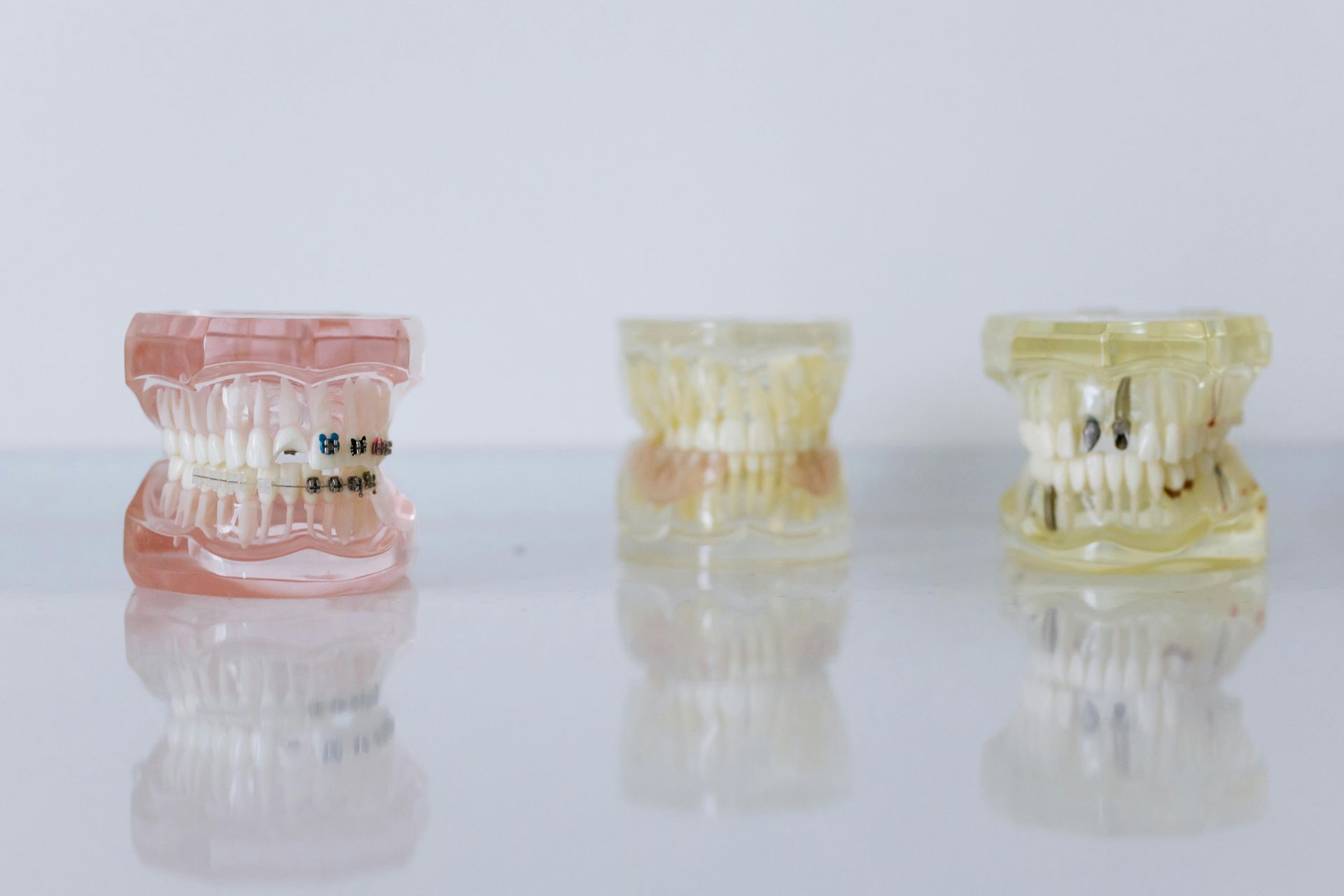 Three dental models are sitting next to each other on a table.