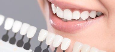Beautiful smile and white teeth of a young woman — Dental Care in Greenville, SC