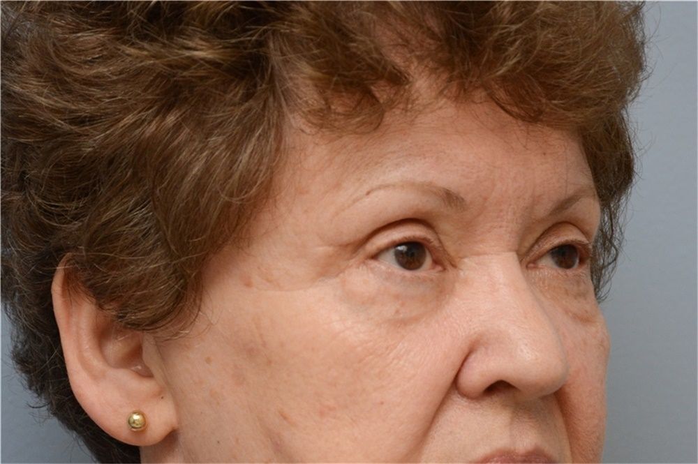 Close-up of a woman’s face in profile with short curly hair, looking to the right, wearing a small gold earring