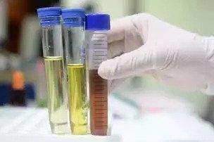 veterinarian performing diagnostic testing.  3 tubes are shown.