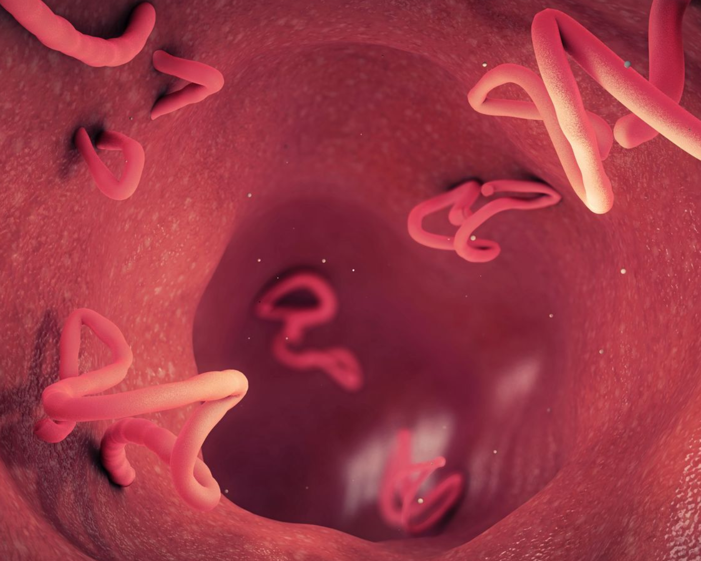 Natural parasite cleanse