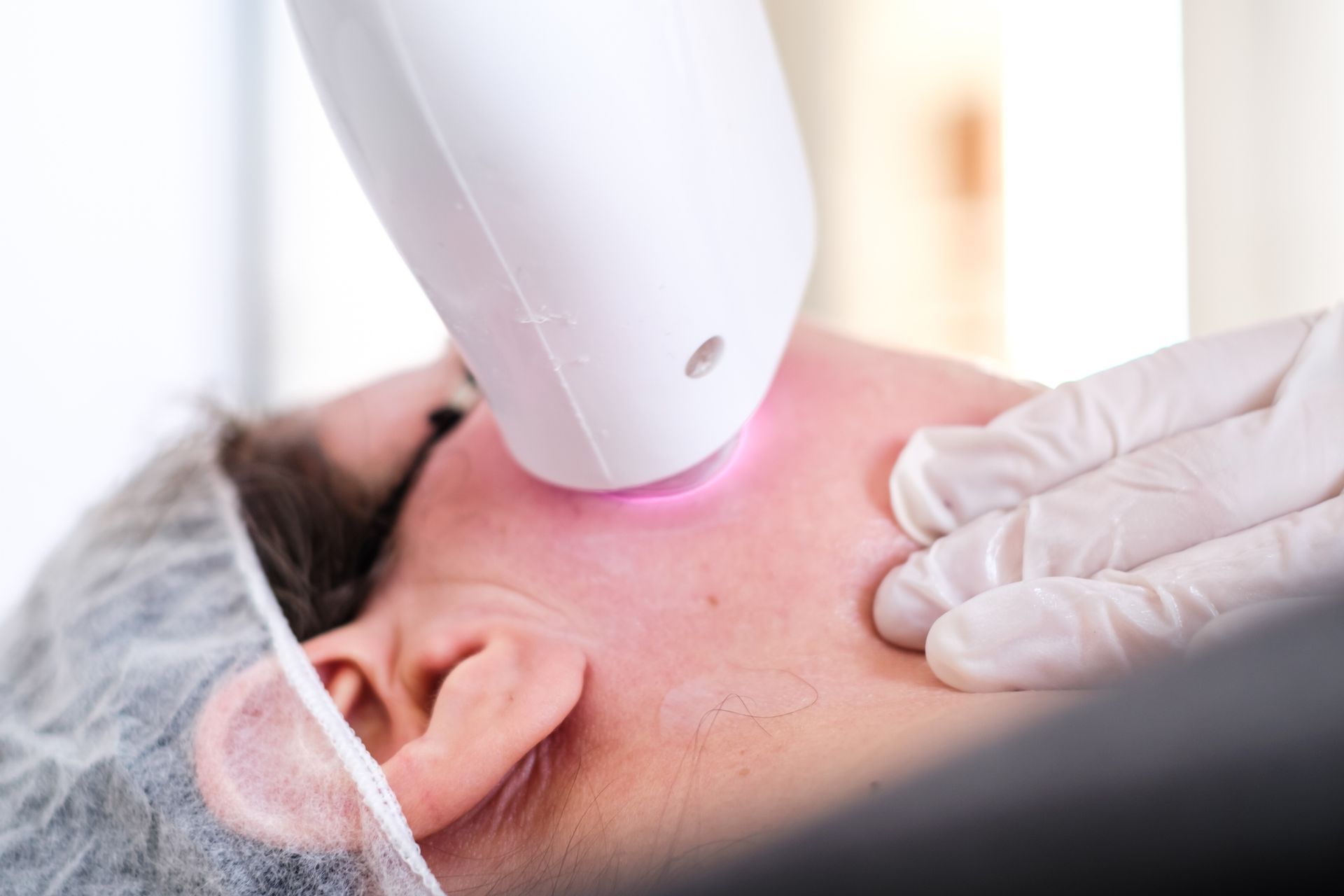 Laser Treatment On A Woman — Sevierville, TN — Greenbrier Medical & Spa
