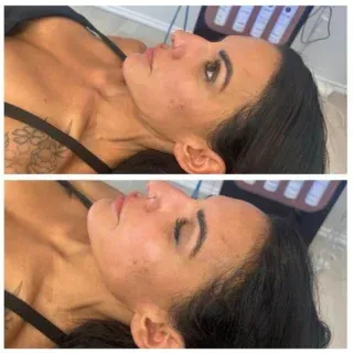 A woman with a tattoo on her chest is laying down