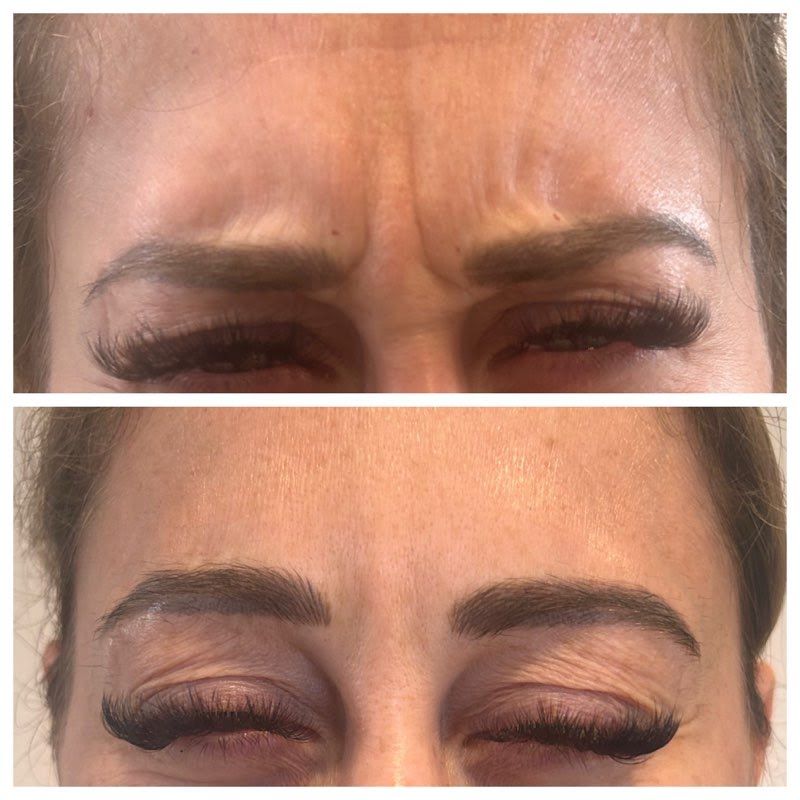 Before and after of a woman's eyebrows
