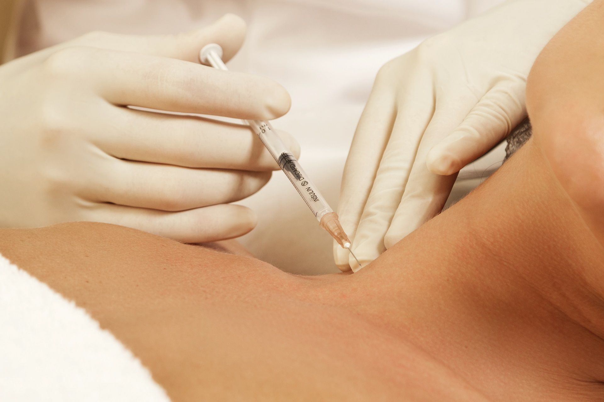 Retatrutide treatment