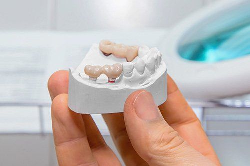 a person is holding a model of teeth in their hand .