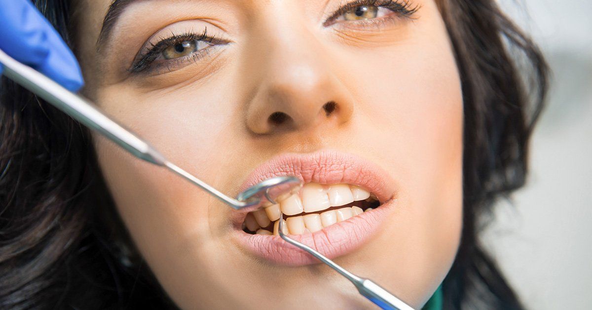 How to Prevent Tooth Extraction - Dental Procedures to Save Teeth