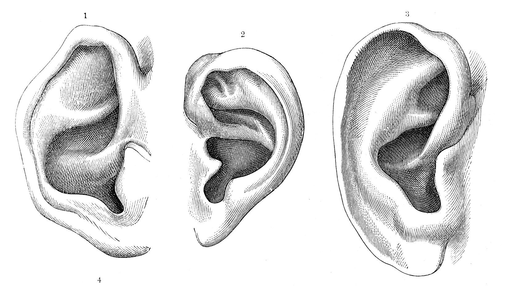 Þrjár ítarlegar myndir af eyrum manna frá mismunandi sjónarhornum.