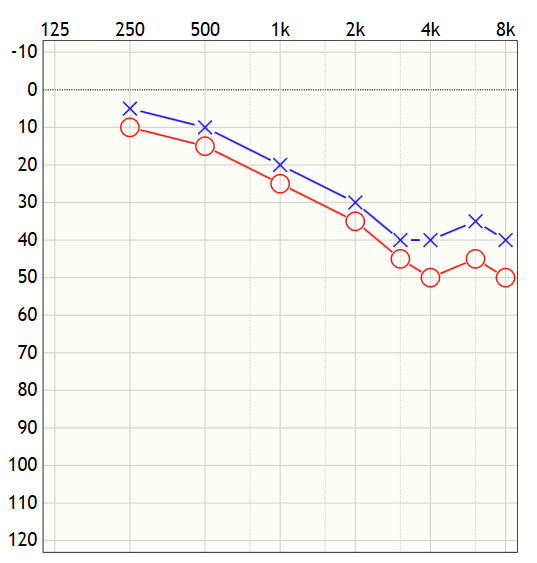 Hljóðrit sem sýnir heyrnarþröskulda, með betri heyrn á lægri tíðnum.