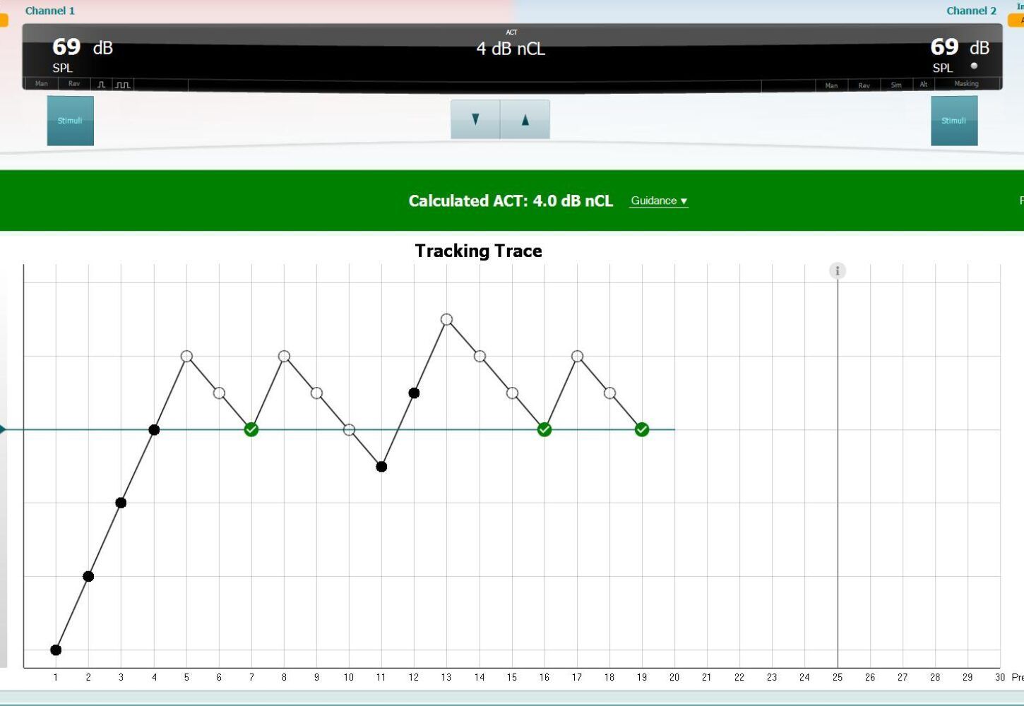 Graf með titlinum „Rakningarslóð“ með sveiflukenndri línu, hitamælingum fyrir ofan og grænum og svörtum punktum.