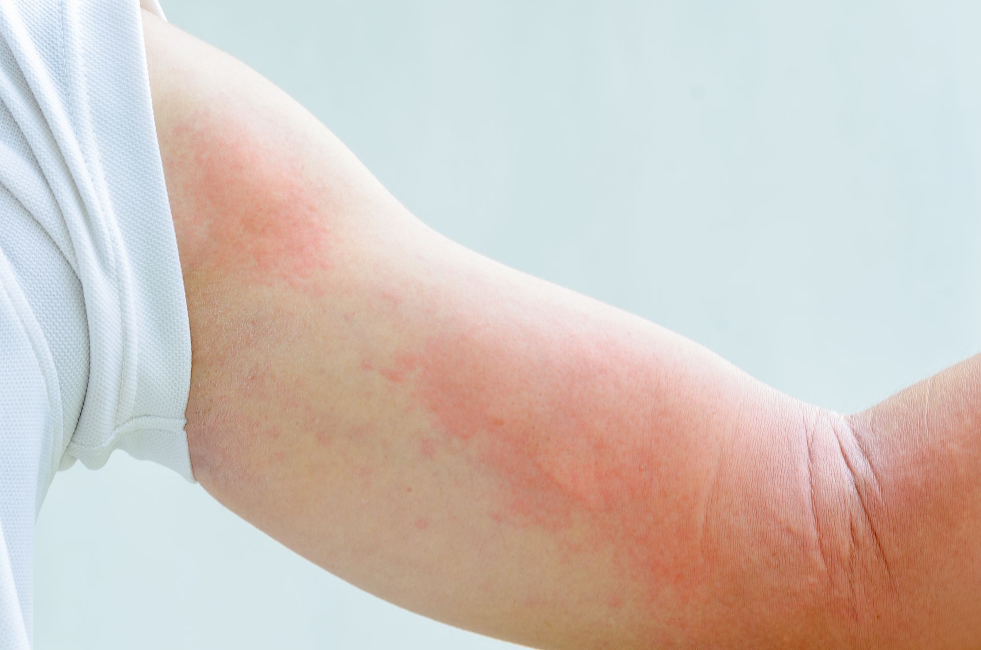ALLERGOLOGIA