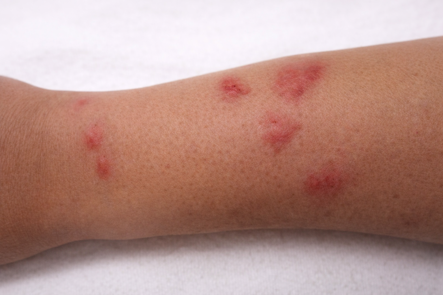 bedwants beten op arm