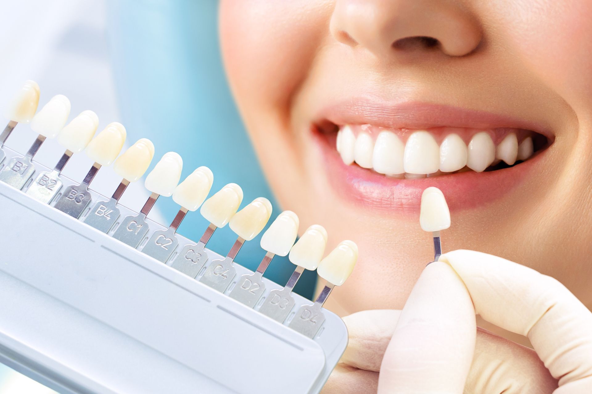Woman smiling with bright white teeth, comparing shade to tooth color samples in a dental office.