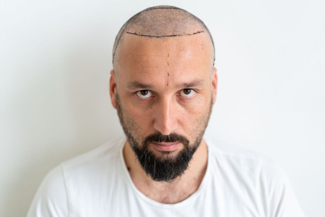 trattamenti anti età
