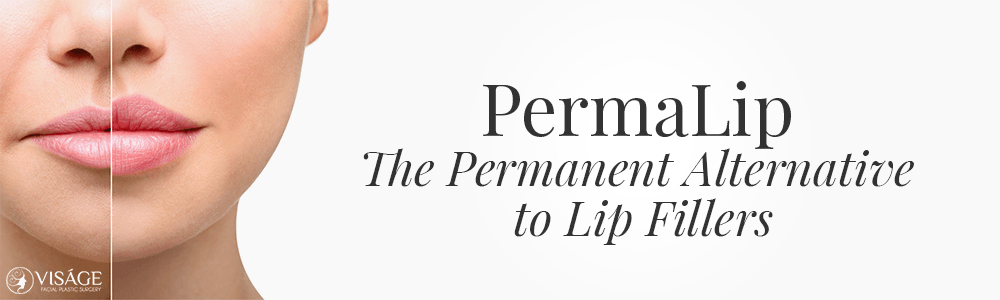 PermaLip implant +  permanent lip fillers
