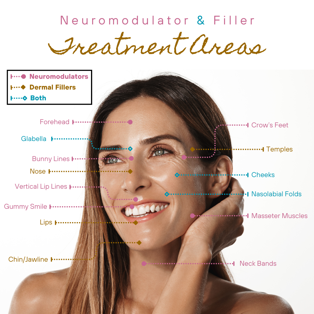 diagram of face with dermal filler and neuromodulator treatment areas