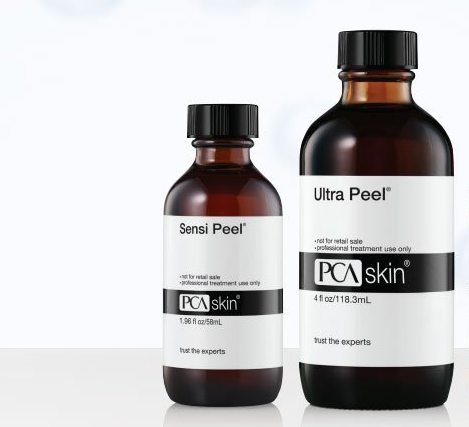 tca chemical peel