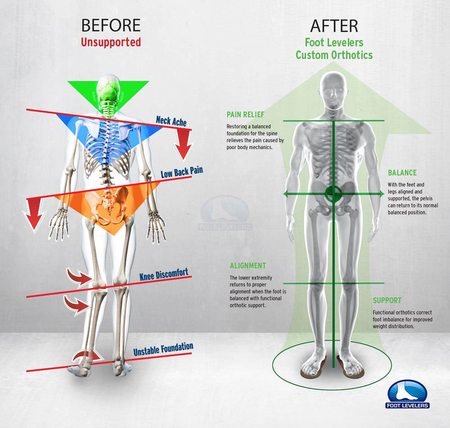 Back Pain Chart — Diamond, IL — Diamond Therapy Center