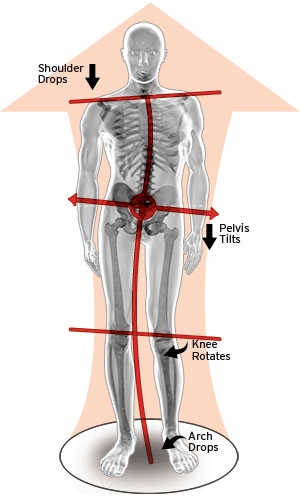 Lower Back Pain Visual — Diamond, IL — Diamond Therapy Center