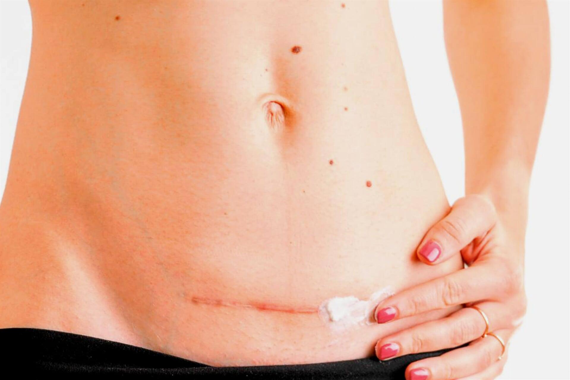 DR. JORGE CARLOS KU VALENCIA - CIRUGÍA GINECOLÓGICA