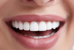 A woman is sitting in a dental chair looking at her teeth in a mirror.