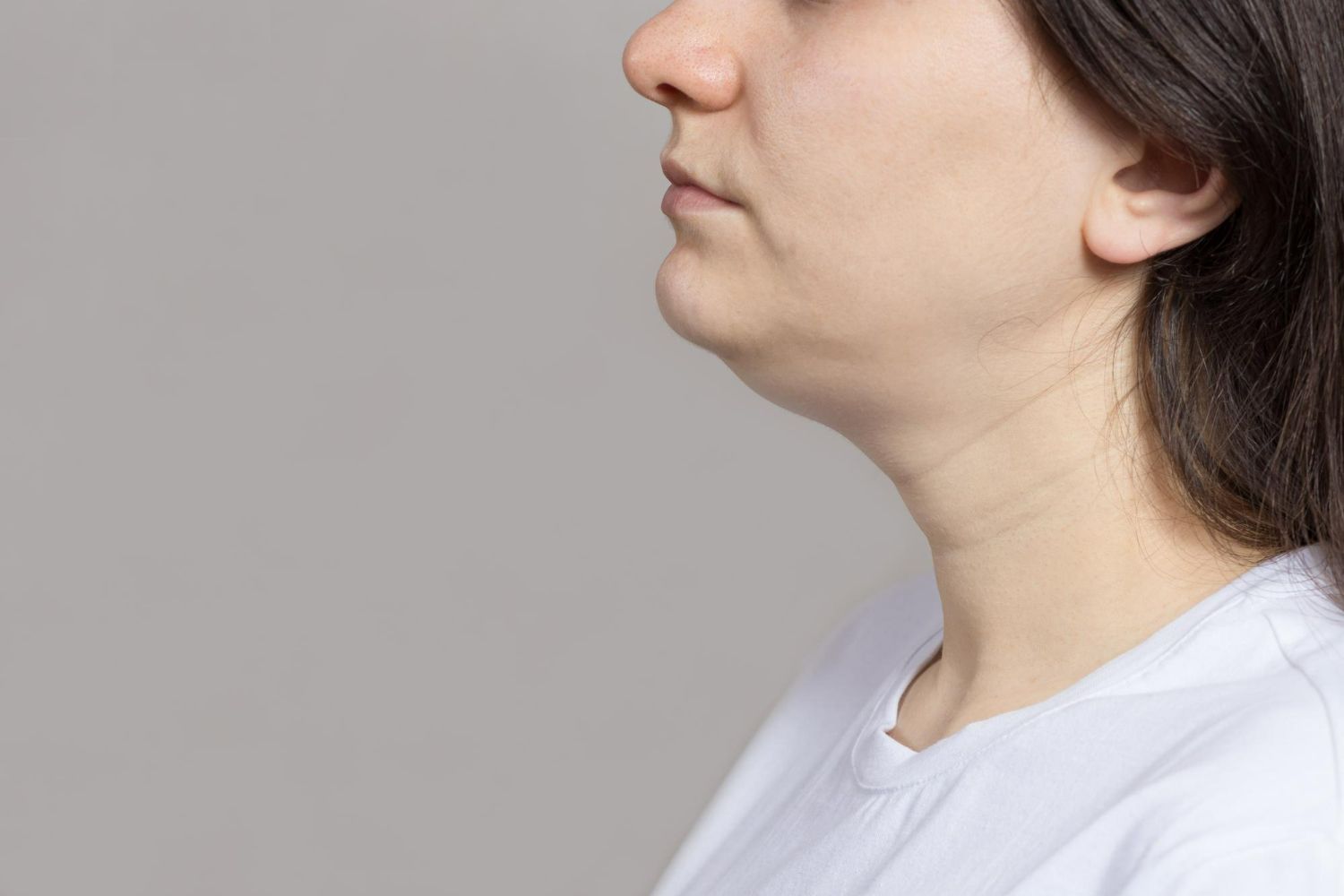 Woman with a double chin, seen in profile, wearing a white shirt against a gray backdrop.