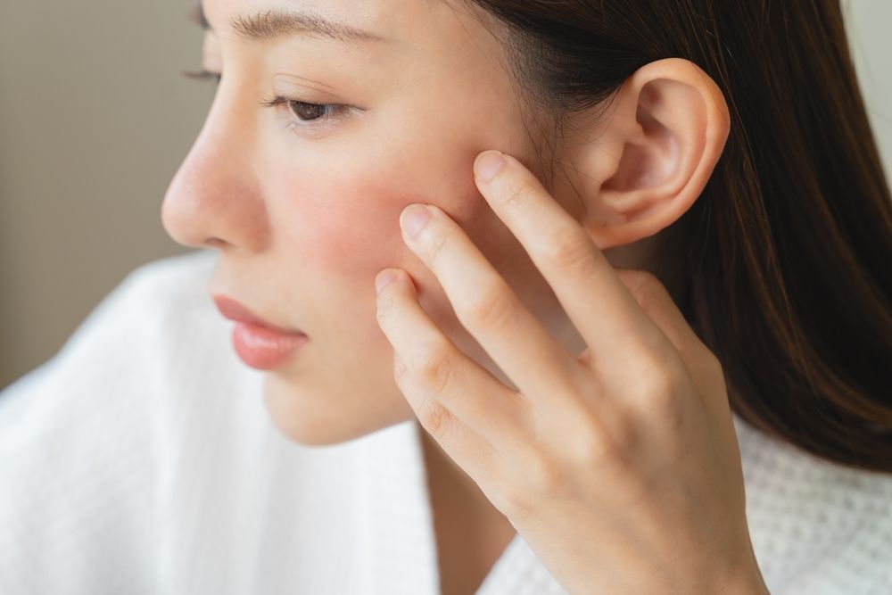Woman with fair skin touches her cheek, showing redness. She has brown hair and wears a white robe.