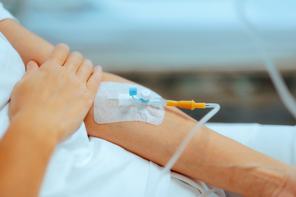 A close-up of a person's arm with an intravenous (IV) catheter secured by a transparent dressing and connected to tubing.