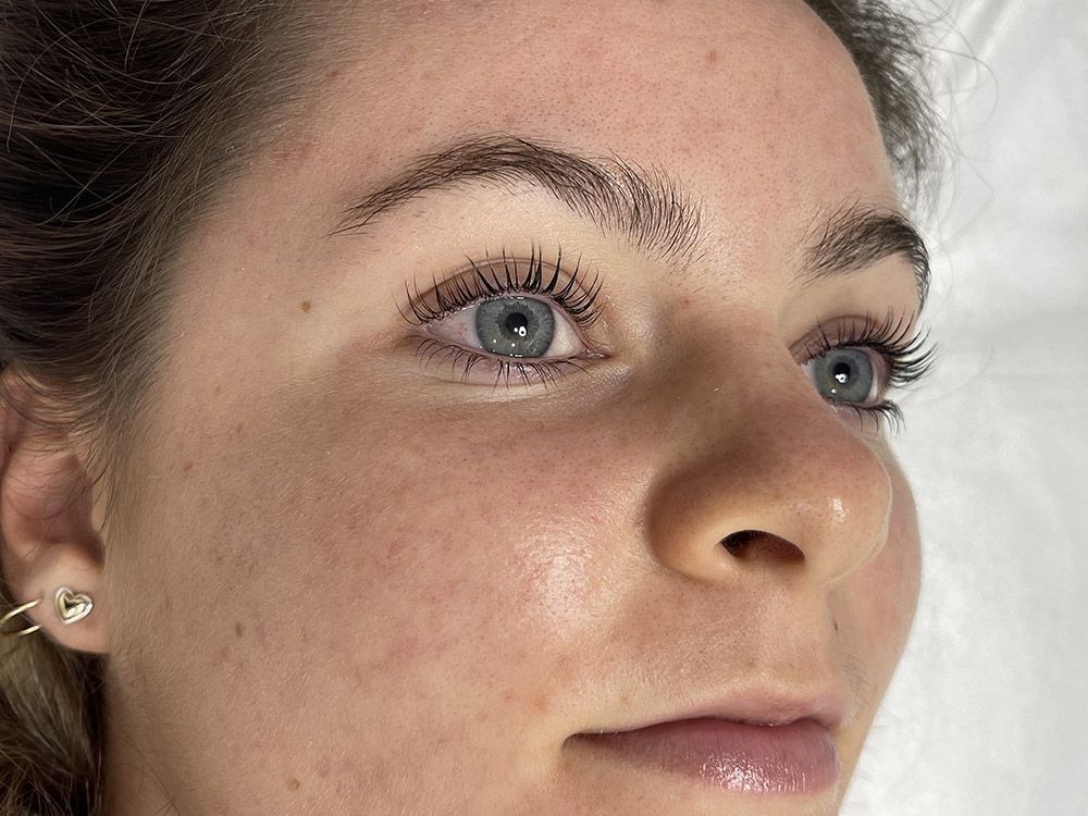 Woman Lying in a Bed After Eyelash Lift — Brow & Lash Clinic In Cairns